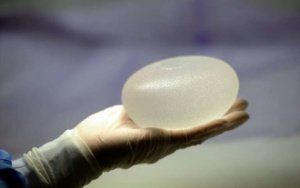 Silicone implants are used for breast enhancement
