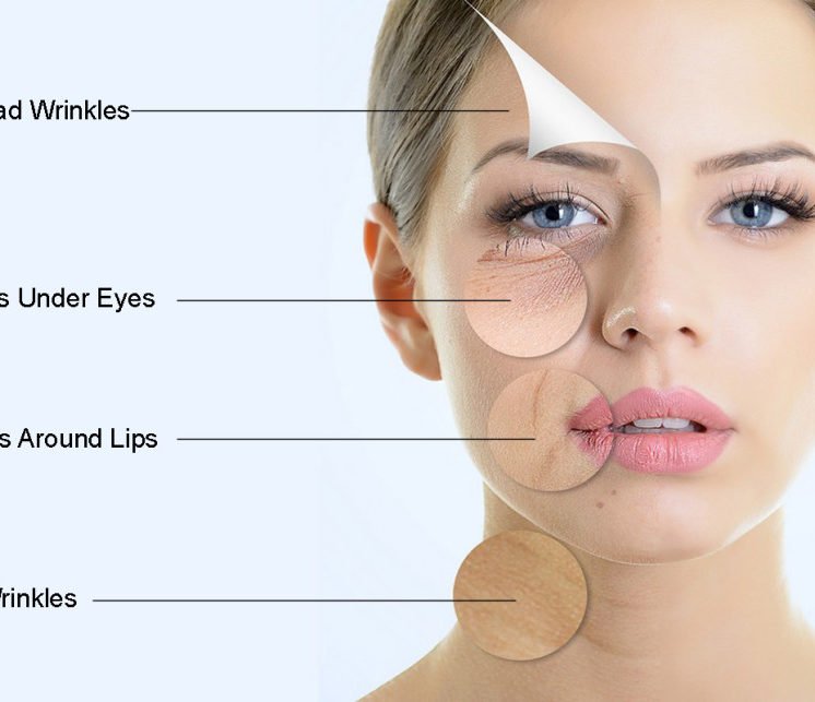 Facelift in Chandigarh | Face wrinkles treatment in Chandigarh